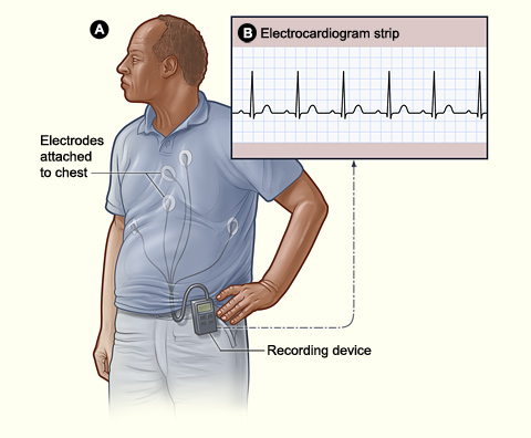 What To Expect From A Good Holter Monitor Reading
