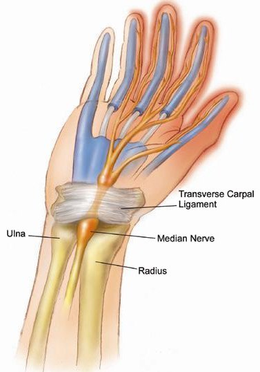 Pain On Wrist