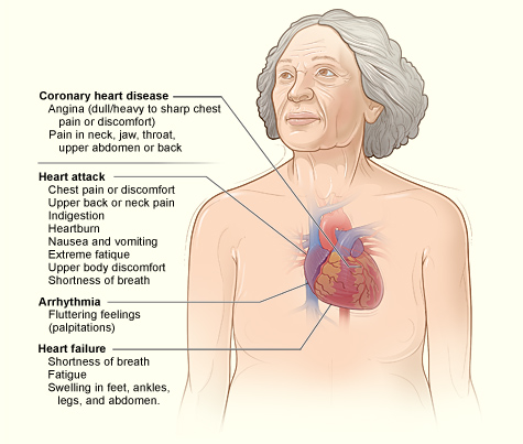 Heart attack symptoms women over 40