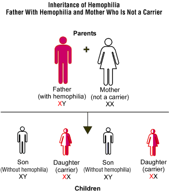 Genetics Of Hemophilia
